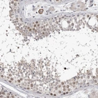 Immunohistochemical staining of human testis shows high expression.