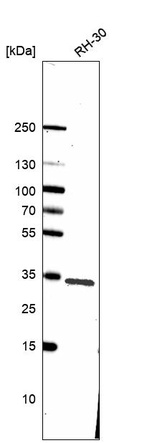 Western blot analysis in human cell line RH-30.