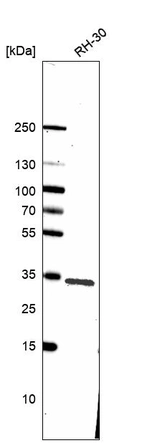Western blot analysis in human cell line RH-30.