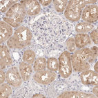 Anti-FABP1 Antibody
