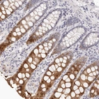 Immunohistochemical staining of human colon shows strong cytoplasmic positivity in glandular cells.