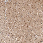Immunohistochemical staining of human liver shows strong cytoplasmic positivity in hepatocytes.