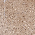 Immunohistochemical staining of human liver shows strong cytoplasmic positivity in hepatocytes.