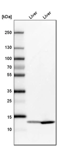 Western blot analysis in mouse liver tissue and rat liver tissue.