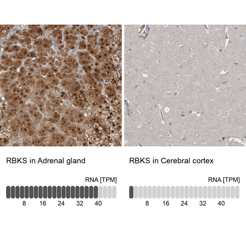 Anti-RBKS Antibody