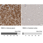 Anti-RBKS Antibody