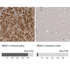 Anti-RBKS Antibody