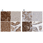 Immunohistochemical staining of human adrenal gland, cerebral cortex, liver and testis using Anti-RBKS antibody HPA028285 (A) shows similar protein distribution across tissues to independent antibody HPA019725 (B).