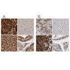 Immunohistochemical staining of human adrenal gland, cerebral cortex, liver and testis using Anti-RBKS antibody HPA028285 (A) shows similar protein distribution across tissues to independent antibody HPA019725 (B).