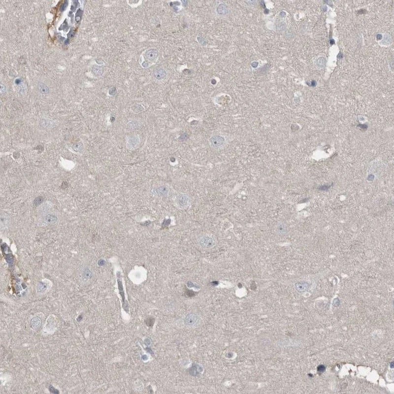 Rabbit Polyclonal Anti-RBKS Antibody - Buy for research - Highly ...