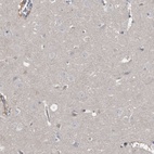 Immunohistochemical staining of human cerebral cortex shows low expression as expected.