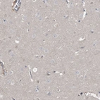 Immunohistochemical staining of human cerebral cortex shows low expression as expected.