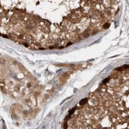 Immunohistochemical staining of human testis using Anti-RBKS antibody HPA028285.
