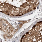Immunohistochemical staining of human testis using Anti-RBKS antibody HPA028285.