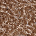 Immunohistochemical staining of human liver using Anti-RBKS antibody HPA028285.