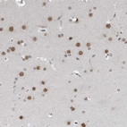 Anti-C8orf58 Antibody