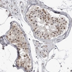 Immunohistochemical staining of human testis shows moderate nuclear positivity in cells in seminiferous ducts.