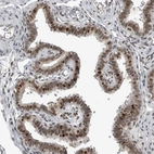 Immunohistochemical staining of human fallopian tube shows strong nuclear positivity in glandular cells.