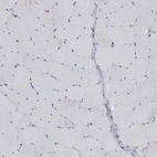 Immunohistochemical staining of human skeletal muscle shows no nuclear positivity in myocytes as expected.