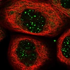 Immunofluorescent staining of human cell line A-431 shows localization to nuclear bodies.