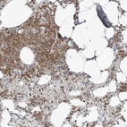 Immunohistochemical staining of human bone marrow shows high expression.