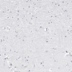 Immunohistochemical staining of human cerebral cortex shows low expression as expected.