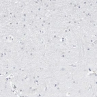 Immunohistochemical staining of human cerebral cortex shows low expression as expected.