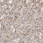 Immunohistochemical staining of human kidney shows strong nuclear positivity in cells in tubules.