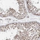 Immunohistochemical staining of human testis shows moderate nuclear positivity in cells in seminiferous ducts.
