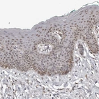 Immunohistochemical staining of human skin shows moderate nuclear positivity in squamous epithelial cells.
