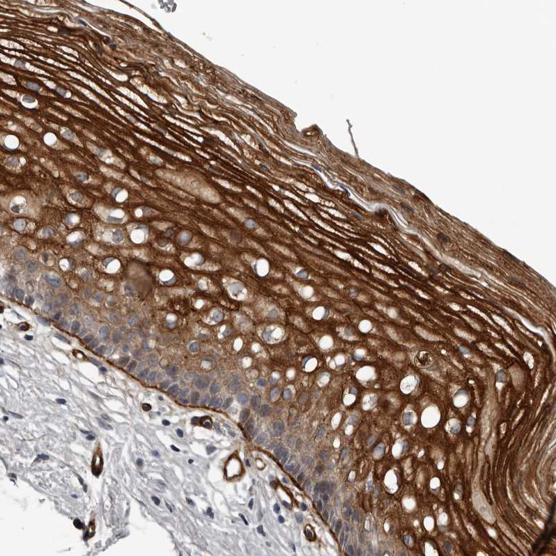 Anti-C1orf216 Antibody