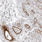 Immunohistochemical staining of human rectum shows strong cytoplasmic positivity in endothelial cells.