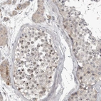 Immunohistochemical staining of human testis shows moderate positivity in nucleoli in cells in seminiferous ducts.