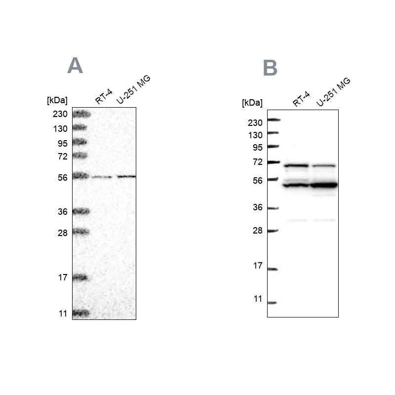 Anti-COQ8B Antibody