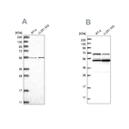 Anti-COQ8B Antibody