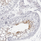 Immunohistochemical staining of human testis shows moderate cytoplasmic positivity in a subset of cells in seminiferous ducts.