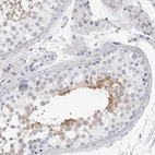 Immunohistochemical staining of human testis shows moderate cytoplasmic positivity in a subset of cells in seminiferous ducts.