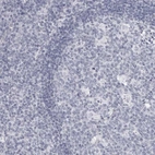 Immunohistochemical staining of human tonsil shows no positivity in lymphoid cells as expected.