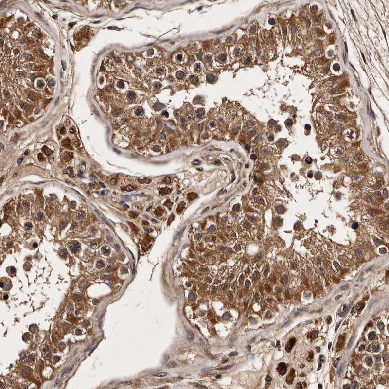 Anti-PARS2 Antibody