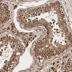 Anti-PARS2 Antibody