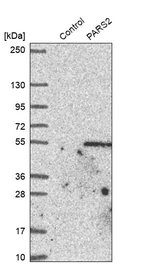 Western blot analysis in control (vector only transfected HEK293T lysate) and PARS2 over-expression lysate (Co-expressed with a C-terminal myc-DDK tag (~3.1 kDa) in mammalian HEK293T cells, LY407690).