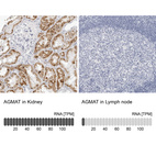 Anti-AGMAT Antibody