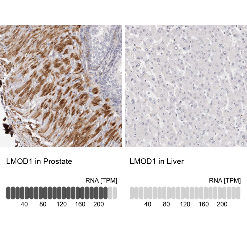 Anti-LMOD1 Antibody