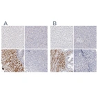 Immunohistochemical staining of human liver, pancreas, prostate and tonsil using Anti-LMOD1 antibody HPA028325 (A) shows similar protein distribution across tissues to independent antibody HPA030097 (B).