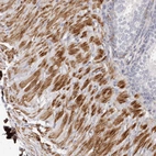 Immunohistochemical staining of human prostate shows strong cytoplasmic positivity in smooth muscle cells.