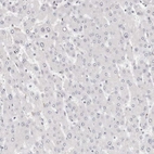 Immunohistochemical staining of human liver shows no positivity in hepatocytes as expected.