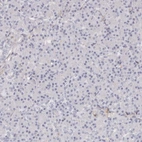 Immunohistochemical staining of human pancreas shows no positivity in exocrine glandular cells as expected.