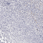 Immunohistochemical staining of human tonsil shows no positivity in non-germinal center cells as expected.