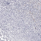 Immunohistochemical staining of human tonsil shows no positivity in non-germinal center cells as expected.