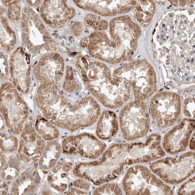 Anti-AKAP7 Antibody